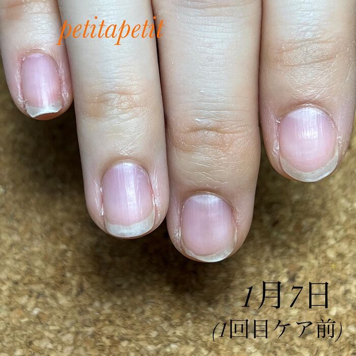 画像1504