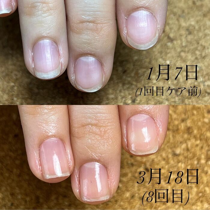 画像1506